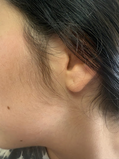 Before treatment 2