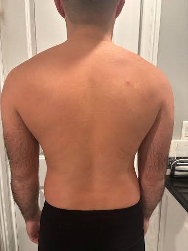 After treatment 3