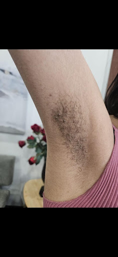 Before treatment 4