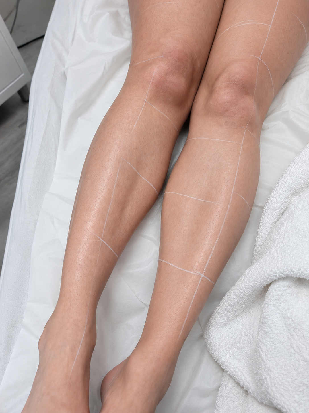 Legs after treatment